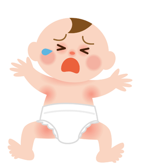 乳児（小児）湿疹